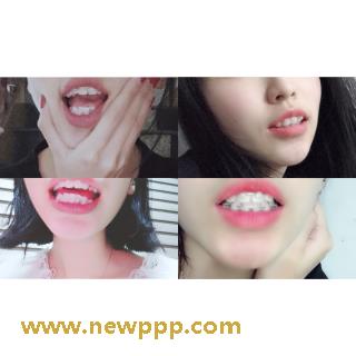 NWF-159