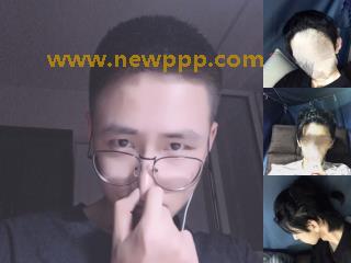 PBD-006